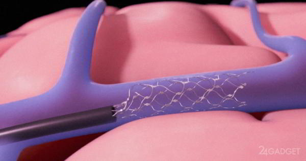 Передавать данные между мозгом и ПК можно по венам человека (4 фото + видео) Передавать данные между мозгом и ПК можно по венам человека (4 фото + видео)