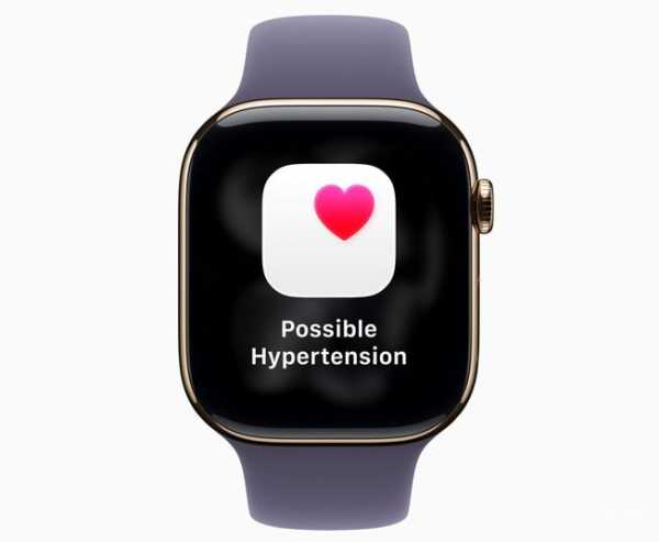 Apple выпустила watchOS 26: дизайн Liquid Glass, новые функции Apple Intelligence и мониторинг гипертонии (8 фото) Apple выпустила watchOS 26: дизайн Liquid Glass, новые функции Apple Intelligence и мониторинг гипертонии (8 фото)