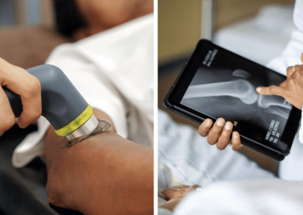 Корейские учёные сделали пистолет для заживления костей