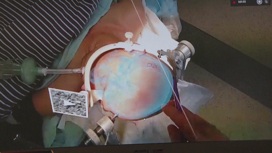 Нейрохирург рассказал об особенностях проведения операций в VR-очках Нейрохирург рассказал об особенностях проведения операций в VR-очках