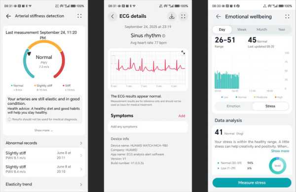 Обзор Huawei Watch Ultimate 2: прочный конкурент Garmin или красивый аксессуар Обзор Huawei Watch Ultimate 2: прочный конкурент Garmin или красивый аксессуар